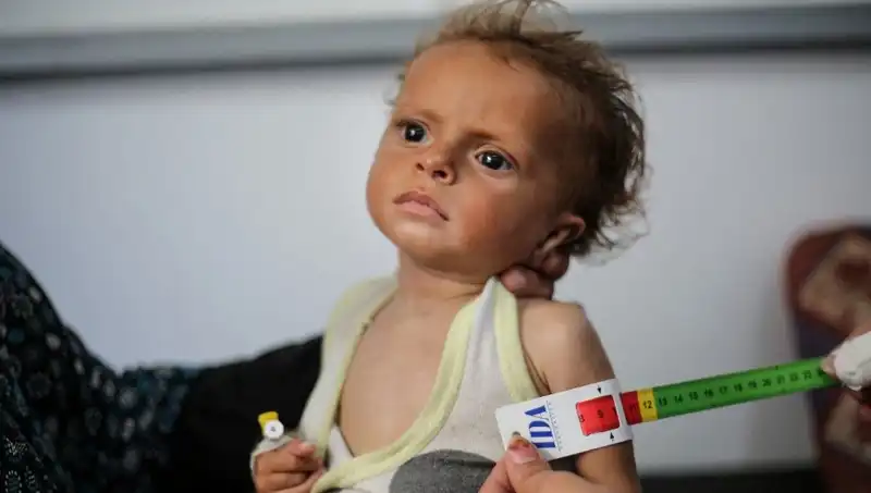 İngiltere, 300 Gazzeli Çocuğa Şans Tanıyor: Yeni Bir Umut Işığı