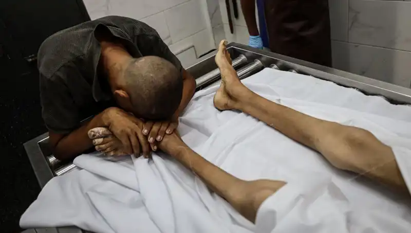 Gazze'de Çocuklar Açlıkla Mücadele Ediyor: Bir Can Daha Kaybedildi