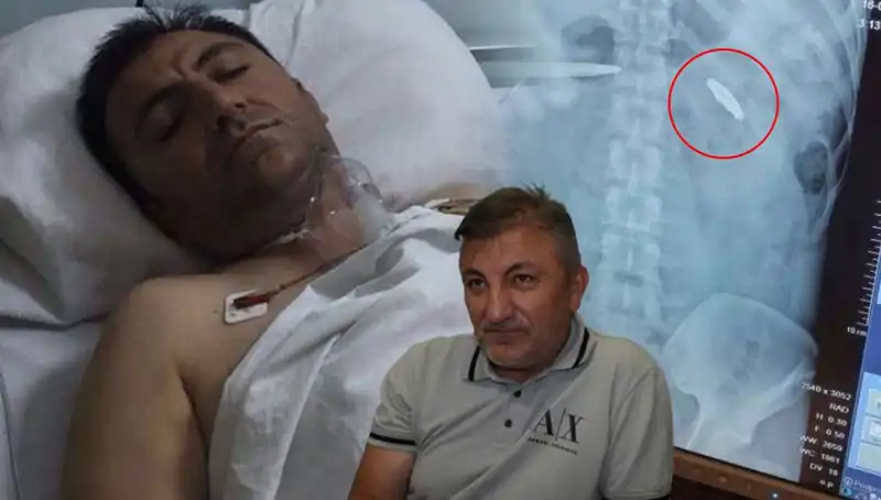 15 Temmuz'un Unutulmaz Yarası: 9 Yıldır Kurşunla Yaşamak