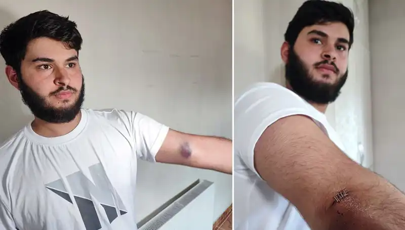 Bahçeye Kaçan Top, Mahallede Gözler Önünde Gerilim Yarattı